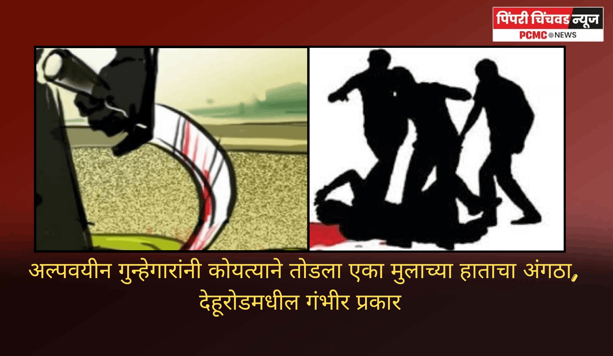 अल्पवयीन गुन्हेगारांनी कोयत्याने तोडला एका मुलाच्या हाताचा अंगठा, देहूरोडमधील गंभीर प्रकार